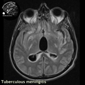 tbc_head MRI_3