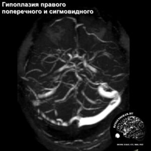 angio_head_MRI_2