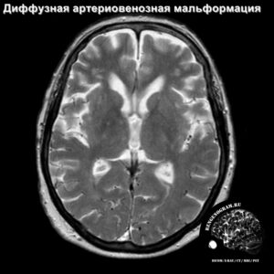awm_head_MRI_1