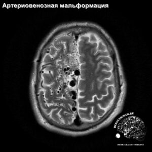 awm_head_MRI_2