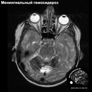 interesting_head_MRI_1