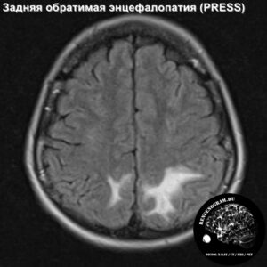 interesting_head_MRI_3
