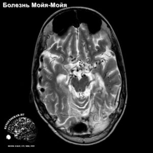 interesting_head_MRI_4